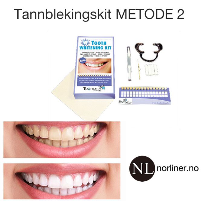 Hovedbilde TF-Tannbleking-KIT Metode-2
